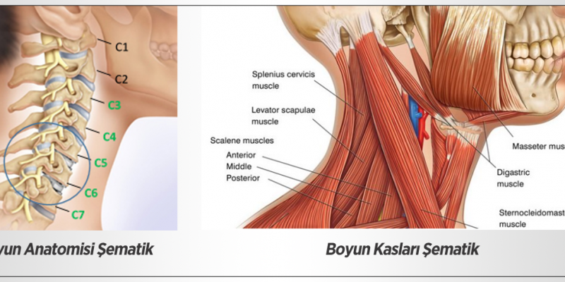 Boyun Ağrısı Neden Olur ?