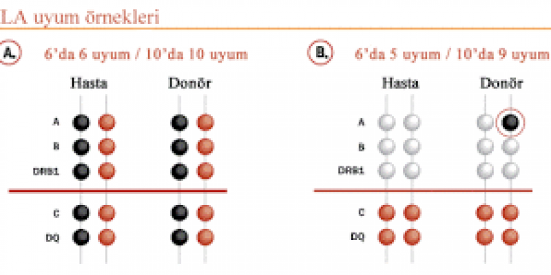 Doku tipi (HLA) testi